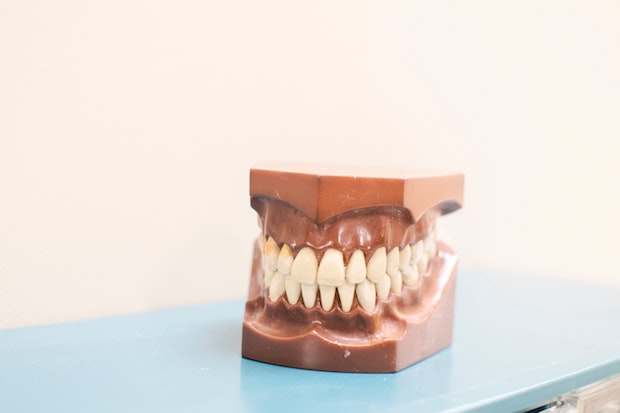 a model of a set of teeth