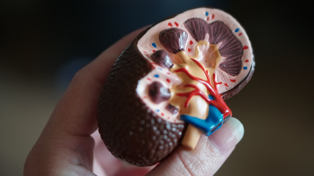 diorama of a kidney